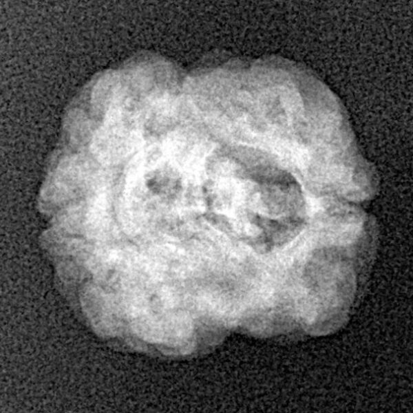 2 Mukhi Rudraksha 20.6mm 1.88gm - Xray