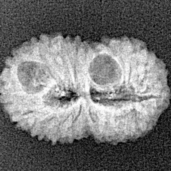 18 Mukhi Rudraksha 20.4mm 1.42gm - Xray