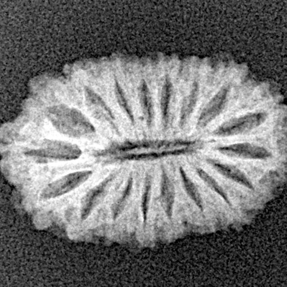18 Mukhi Rudraksha 19.2mm 1.42gm - Xray