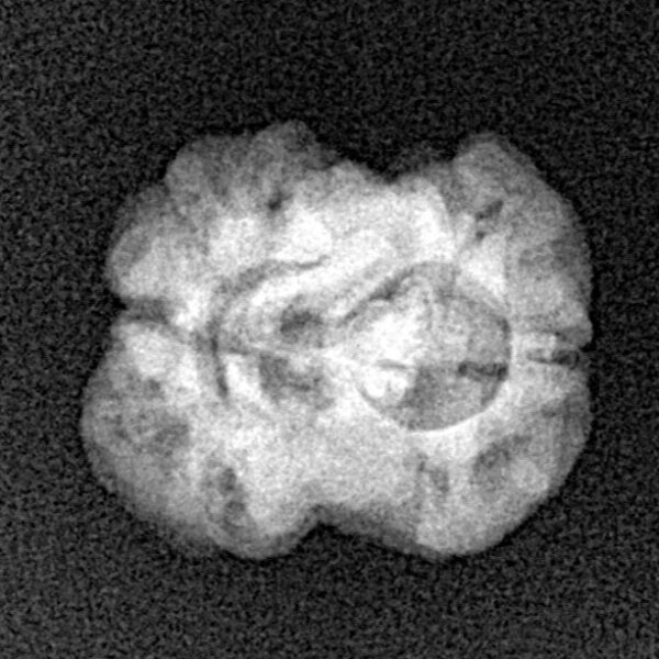 2 Mukhi Rudraksha 21.1mm 1.72gm - Xray