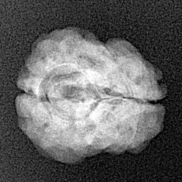 2 Mukhi Rudraksha 22.9mm 1.83gm - Xray