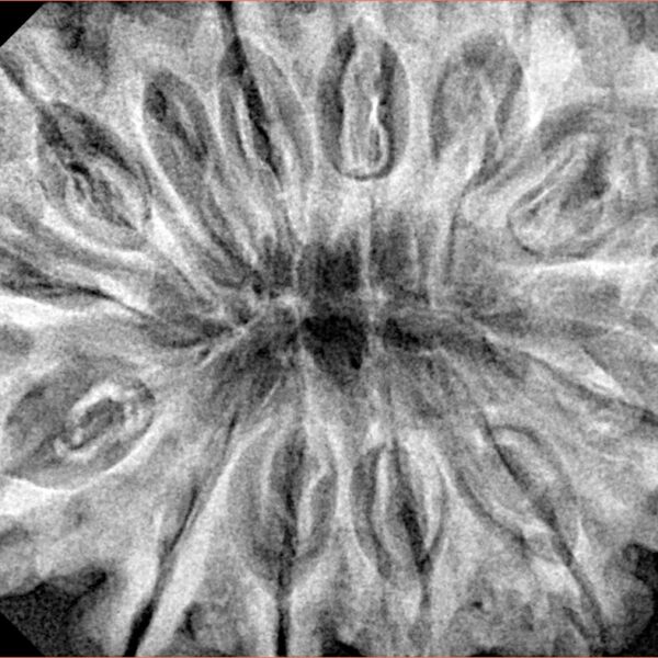 12 Mukhi Rudraksha 36.1mm 9.13gm - Xray