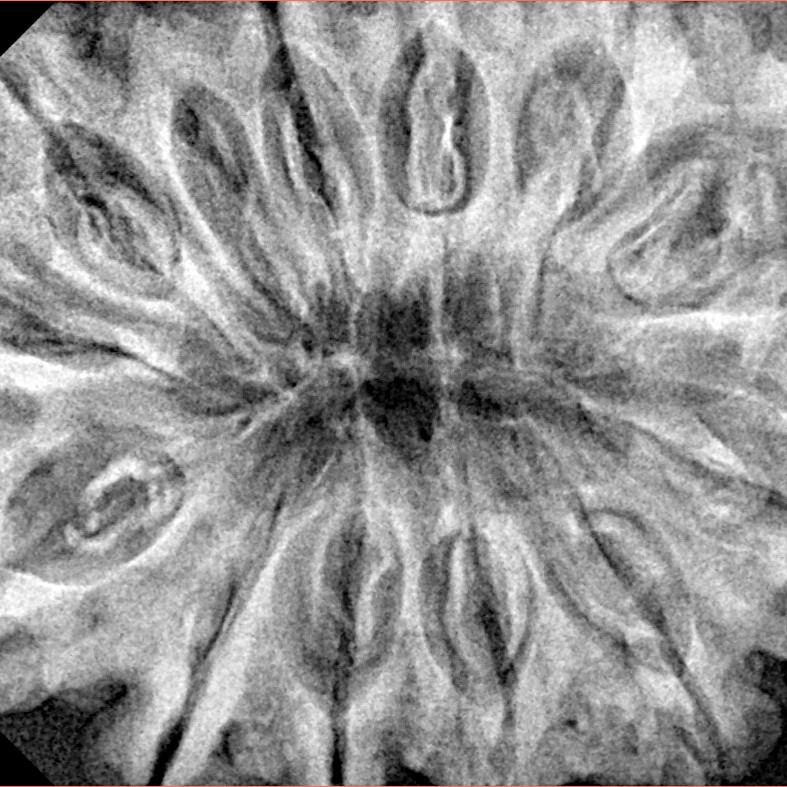 12 Mukhi Rudraksha 36.1mm 9.13gm - Xray