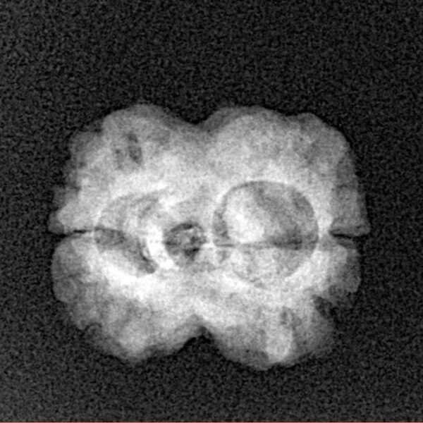 2 Mukhi Rudraksha 23.3mm 2gm - Origin: Nepal - Xray