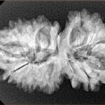 15 Mukhi Gaurishankar 33.9mm 5.18gm - Xray