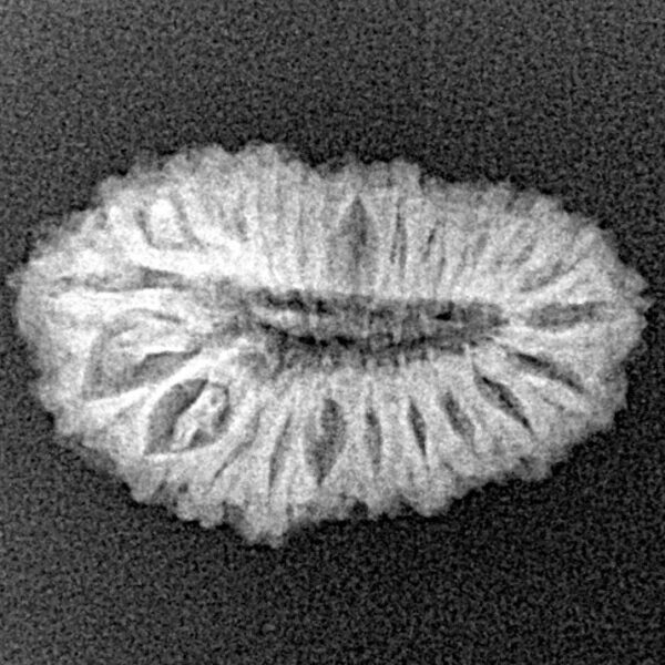 22 Mukhi Rudraksha 22.4mm 1.84gm - Xray