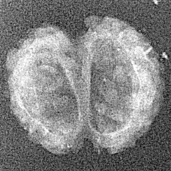 2 Mukhi Gaurishankar 19.1mm 0.74gm - Xray