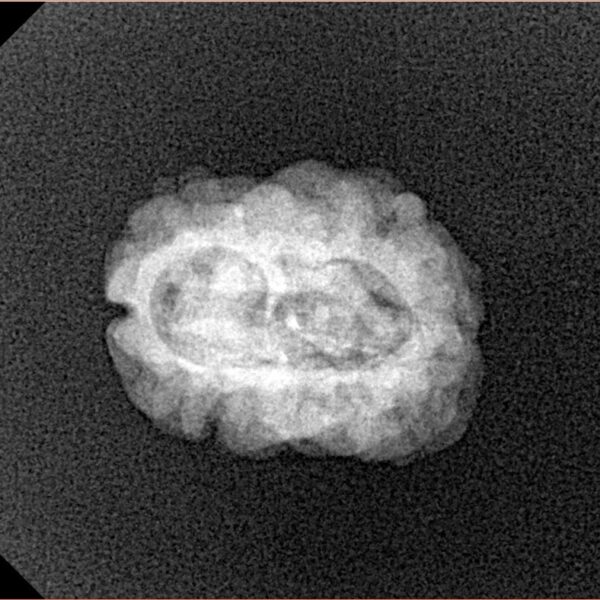 2 Mukhi Rudraksha 23.7mm 1.81gm - Xray