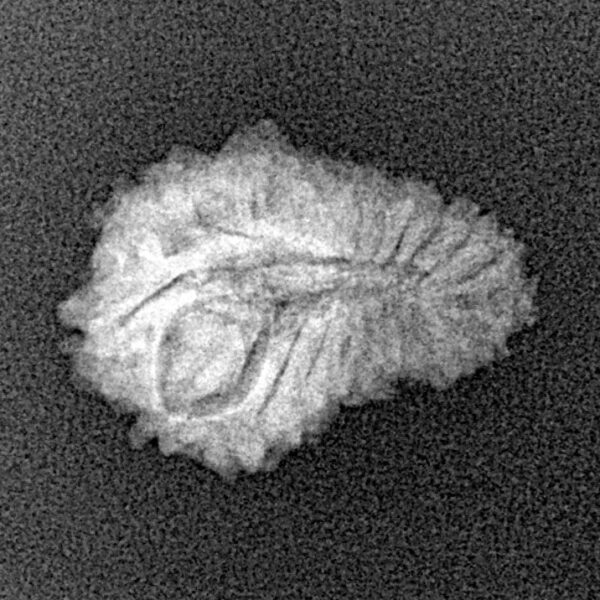 21 Mukhi Rudraksha 18.7mm 1.22gm - Xray