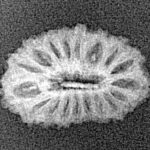 18 Mukhi Rudraksha 17.7mm 0.75gm - Xray