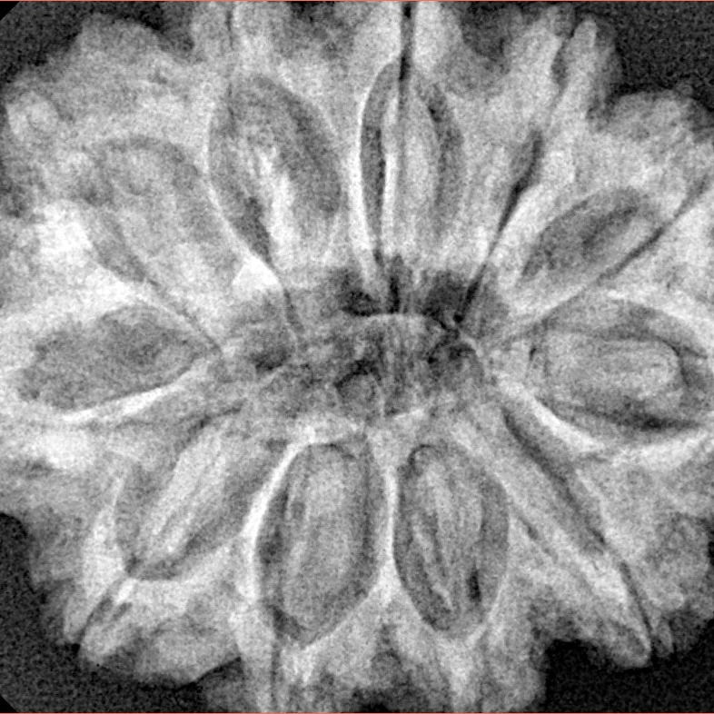 11 Mukhi Rudraksha 32mm 7.17gm - Xray