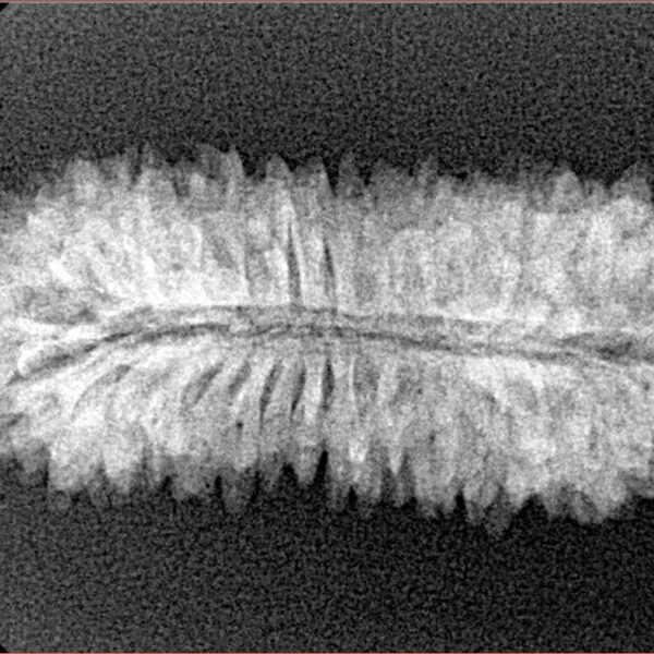 33 Mukhi Rudraksha 31.6mm 3.07gm - Xray