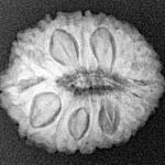 18 Mukhi Rudraksha 19.8mm 2.63gm - Xray