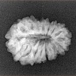 15 Mukhi Rudraksha 20.4mm 2.33gm - Xray