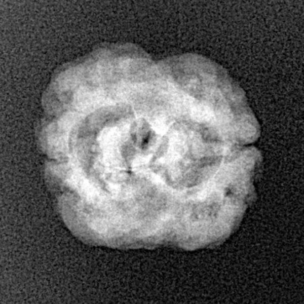 2 Mukhi Rudraksha 21mm 1.84gm - Xray