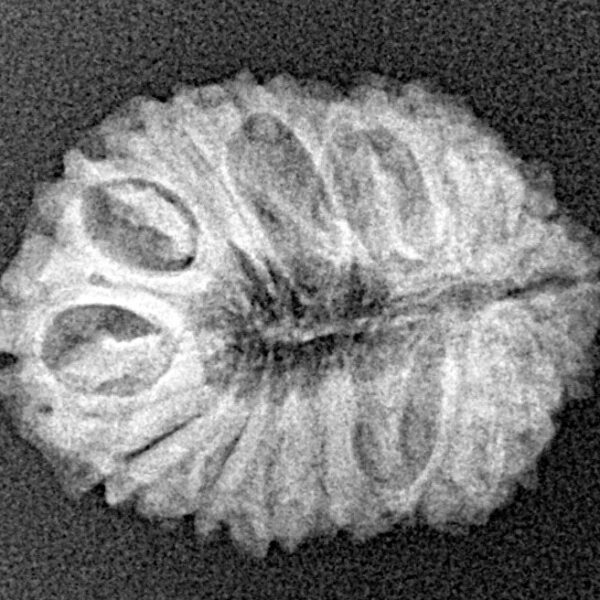 18 Mukhi Rudraksha 22.5mm 2.17gm - Xray