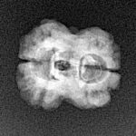 2 Mukhi Rudraksha 20.5mm 1.52gm - Xray