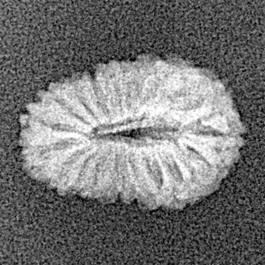 19 Mukhi Rudraksha 14.9mm 0.59gm - Xray