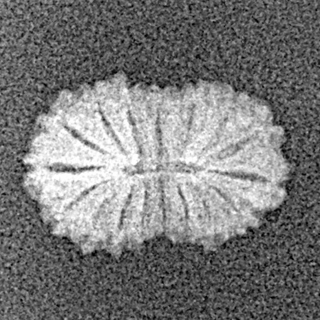 17 Mukhi Rudraksha 12.6mm 0.4gm - Xray