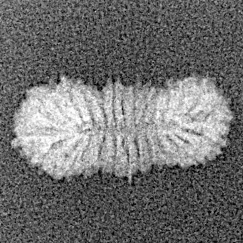 27 Mukhi Rudraksha 14.9mm 0.36gm - Xray