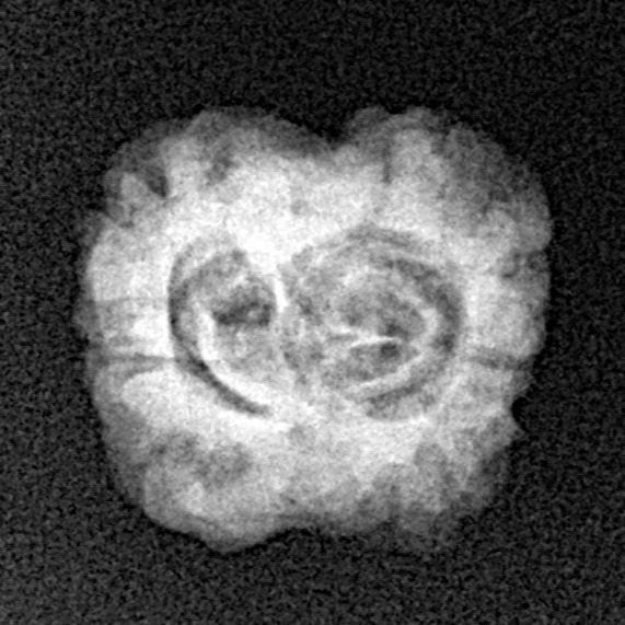 2 Mukhi Rudraksha 23.5mm 1.73gm - Origin: Nepal - Xray