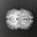 2 Mukhi Rudraksha 20mm 1.64gm - Xray
