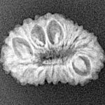 18 Mukhi Rudraksha 19.8mm 1.39gm - Xray