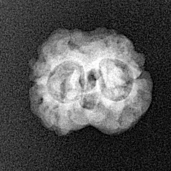2 Mukhi Rudraksha 19.6mm 1.63gm - Xray