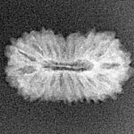 18 Mukhi Rudraksha 19.1mm 1gm - Xray