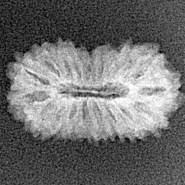 18 Mukhi Rudraksha 19.1mm 1gm - Xray