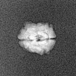 2 Mukhi Rudraksha 11.4mm 0.36gm - Xray