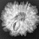 11 Mukhi Rudraksha 21.4mm 3gm - Xray