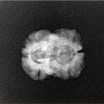 2 Mukhi Rudraksha 22.5mm 1.66gm - Xray