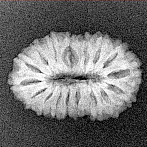 17 Mukhi Rudraksha 21.1mm 1.89gm - Xray