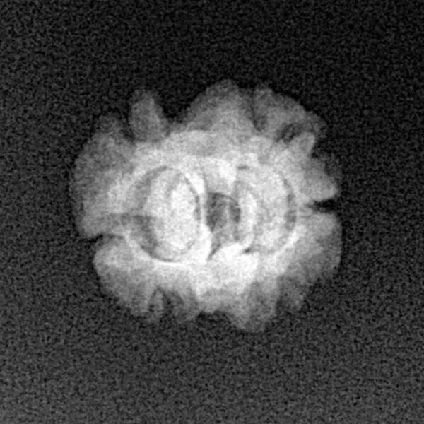 2 Mukhi Rudraksha 19.5mm 1.25gm - Xray