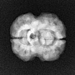 2 Mukhi Rudraksha 22.7mm 2.76gm - Xray
