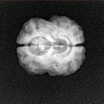 2 Mukhi Rudraksha 23.1mm 2.14gm - Xray