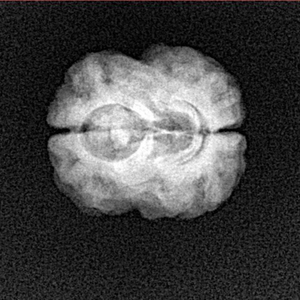 2 Mukhi Rudraksha 23.1mm 2.14gm - Xray
