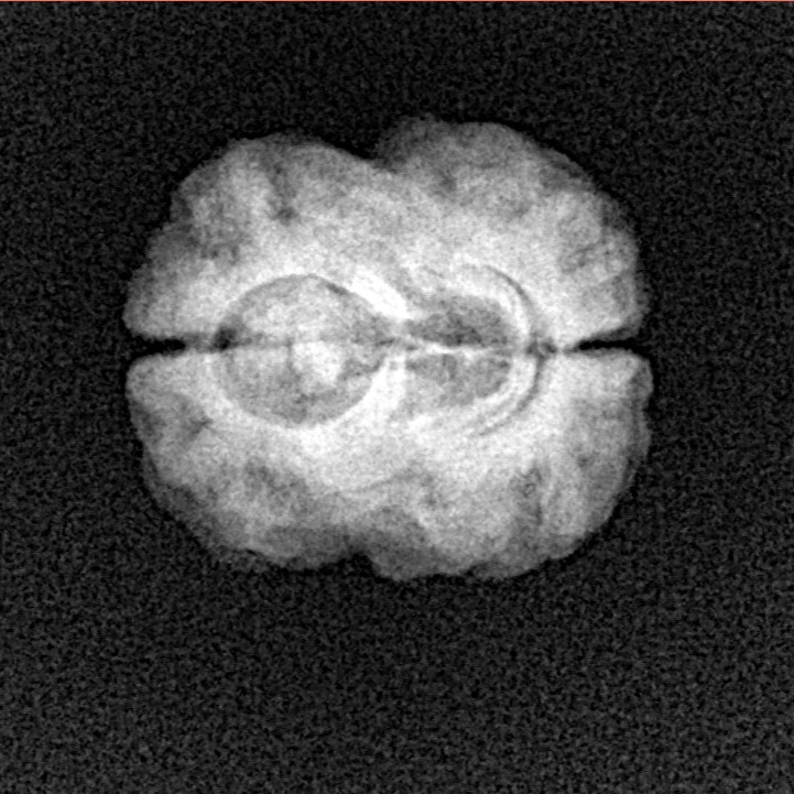 2 Mukhi Rudraksha 23.1mm 2.14gm - Xray