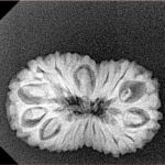 19 Mukhi Rudraksha 23.9mm 2.39gm - Xray