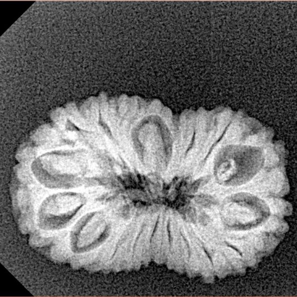 19 Mukhi Rudraksha 23.9mm 2.39gm - Xray