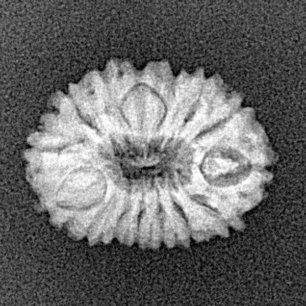 15 Mukhi Rudraksha 17.7mm 1.24gm - Xray