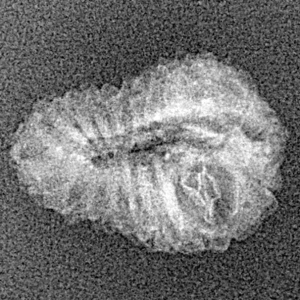 19 Mukhi Rudraksha 18.5mm 0.65gm - Xray