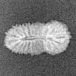 21 Mukhi Rudraksha 14.5mm 0.39gm - Xray