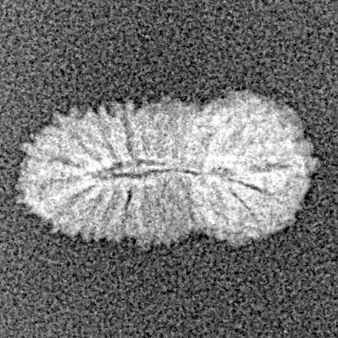 21 Mukhi Rudraksha 14.5mm 0.39gm - Xray