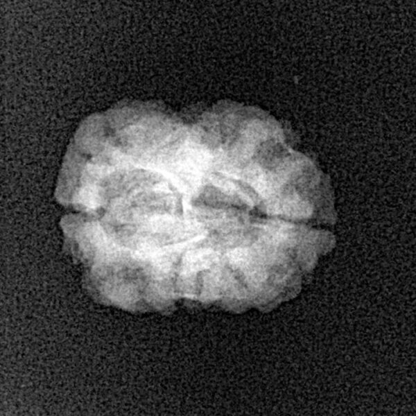 2 Mukhi Rudraksha 20.6mm 1.45gm - Xray