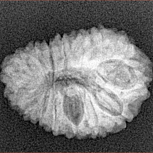 16 Mukhi Rudraksha 21.2mm 2.31gm - Xray