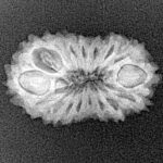 17 Mukhi Rudraksha 22.4mm 1.77gm - Xray
