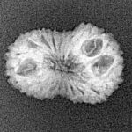 19 Mukhi Rudraksha 19.4mm 1.25gm - Xray