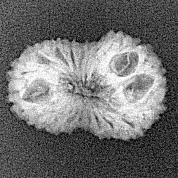 19 Mukhi Rudraksha 19.4mm 1.25gm - Xray